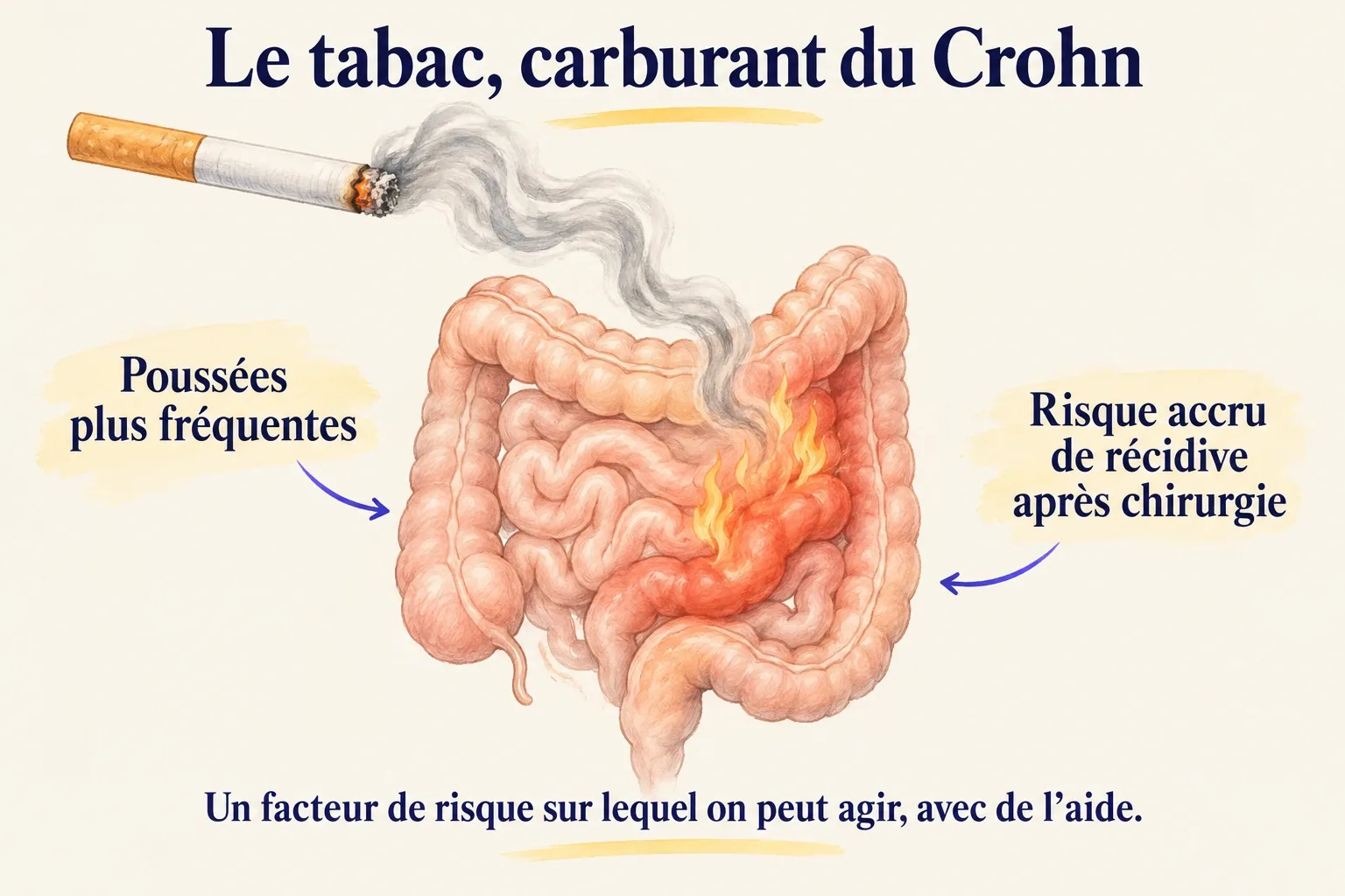 Une cigarette dont la fumée descend vers un intestin qui s'enflamme à son contact